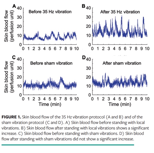 Effect of Local Vibrations on Plantar Skin Blood Flow Responses During